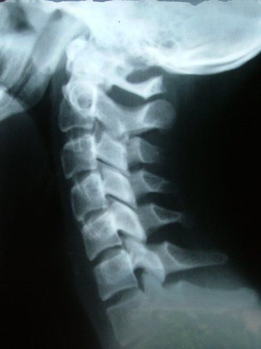 Chiropractic X-Ray